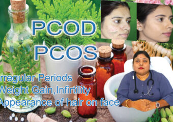 PCOD PCOS